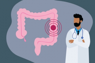 În Republica Moldova va fi implementată o nouă metodă de screening a cancerului