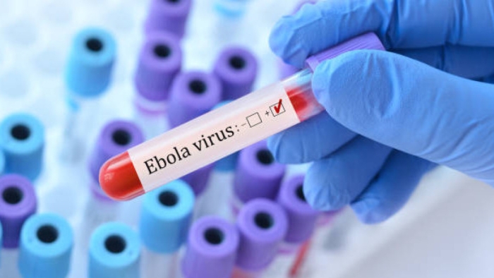Franța a confirmat primul caz de Ebola
